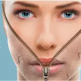 بوتاکس| ژل| فیلر| لیزر گلاریس شیراز