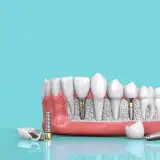 دندانپزشکی دکتر رسول ابوالحسنی