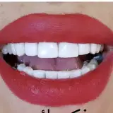 پالیش رایگان ۱۰ ساله، ترمیم رایگان ۱۰ ساله