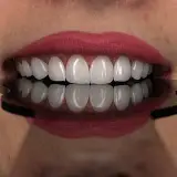 دنتال آریستا قدیم