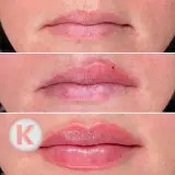 کلینیک کهربا|انواع خدمات زیبایی