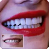 همیشه راهی برای لبخندی زیبا وجود دارد . (دندانپزشکی آریا )