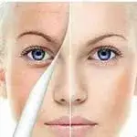 کلینیک پوست زیبایی و لیزر هروی