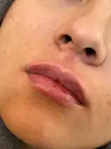 کلینیک زیبایی الین مشهد