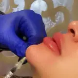 مطب،پوست،زیبایی و لیزر نورا