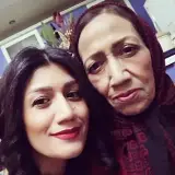 کاشت ناخن سهروردی