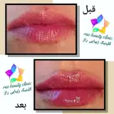 کلینیک زیبایی راز