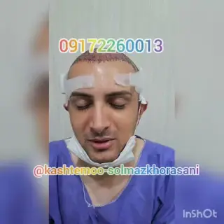 کلینیک کاشت مو در شیراز