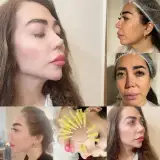 کلینیک زیبایی ماهرو