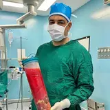 لیپوساکشن_پیکرتراشی_اصفهان