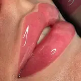 مطب سما