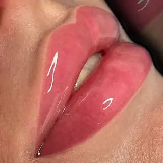 مطب سما