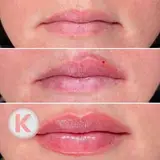 ⚜️کلینیک کهربا|لیزر|لاغری|هایفو|بوتاکس|فیلر|ژل⚜️