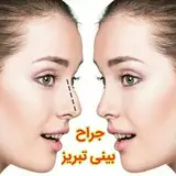 ? جراحی بینی تبریز ?