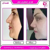 جراحان بینی همدان