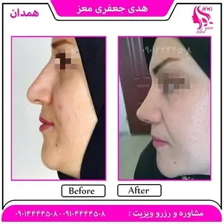 جراحان بینی همدان