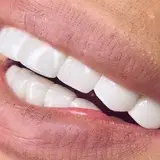لبخند رویایی