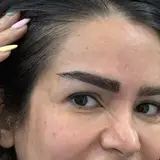 کاشت مو/کاشت ابرو/کاشت ریش