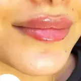کلینیک زیباجویان اهواز