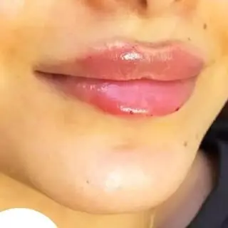 کلینیک زیباجویان اهواز