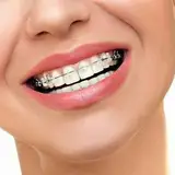 دکتر فاطمه عبدالهی | متخصص ارتودنسی گرگان
