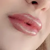 مرکز زیبایی ژل و بوتاکس