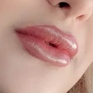 مرکز زیبایی ژل و بوتاکس