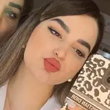 ?تزریق فیلر/بوتاکس/مزو|تهران