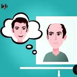 کاشت مو _hmz