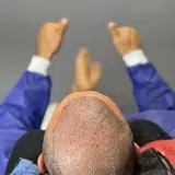 كاشت مو رشت