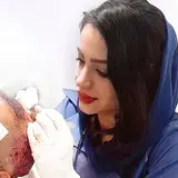 کاشت تخصصی مو، رحمانی.مشهد
