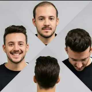 پروتزمو-خانه مو معین