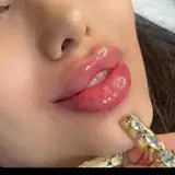 ژل فیلر بوتاکس لیزر هایفو فیشیال