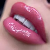 صبا علیزاده | مرکز زیبایی | ژل لب بوتاکس اصفهان