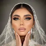 لیزر تندیس