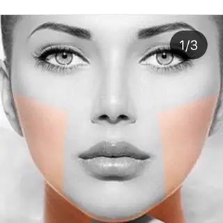 ليزر موي زائد