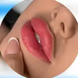 تزریق ژل/فیلرلب روسی/بوتاکس/تهران