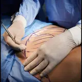 جراحی سعادت آباد?
