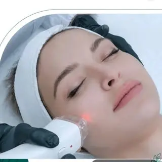 patris_laser