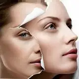 دکتر افشین جلالی/تزریق ژل .بوتاکس.اصفهان.