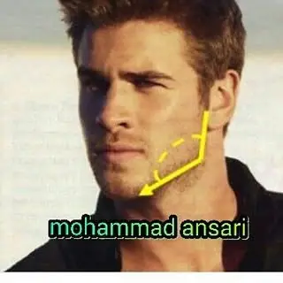زاویه سازی صورت بدون تزریق⛔
