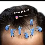 کاشت مو سنندج