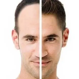 مرکز تخصصی کاشت پیوند