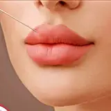 ژل و بوتاکس قم
