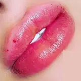 خدمات ژل و بوتاکس اهواز?‍⚕️?