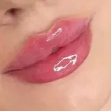 فیلر،ژل،بوتاکس،نخ،آموزش،کاشتمو،بلفاروپلاستی،جراحی