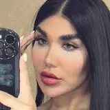 ژل و بوتاکس اهواز|کلینیک زیبایی،لب روسی،مادلینگ صورت