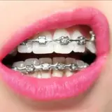 دنتال لبخند ارتودنسی اقساط بدون چک