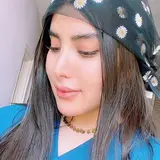 کاشت مو_ابر‌و_ریش
