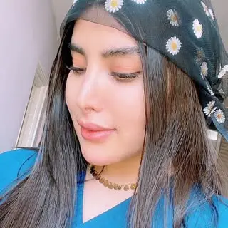 کاشت مو_ابر‌و_ریش